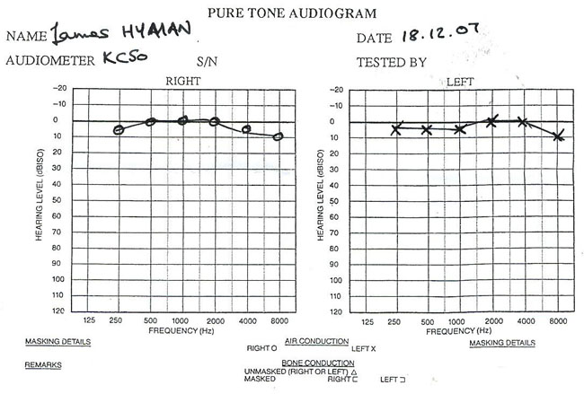 EarTest091.jpg